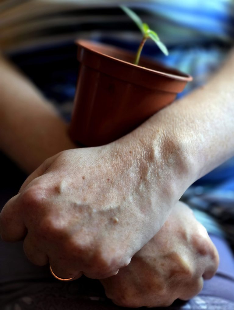 Klaipėdos miesto socialinės paramos centro lankytoja Aldona, 85 m.